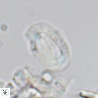 Helicosphaera consimilis VR 05883