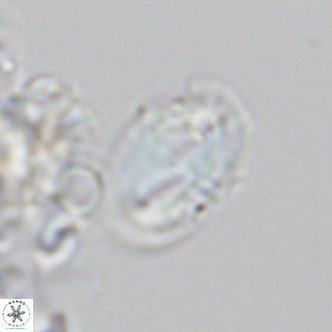 Helicosphaera consimilis VR 05884