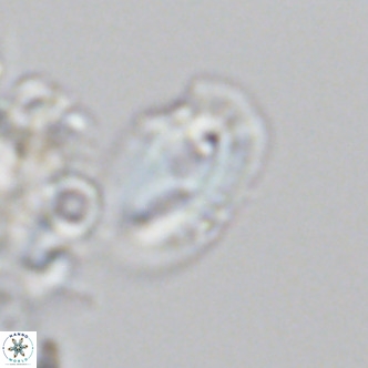 Helicosphaera consimilis VR 05886
