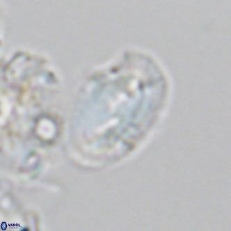 Helicosphaera consimilis VR 05887