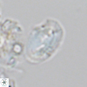 Helicosphaera consimilis VR 05887