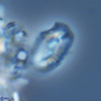 Helicosphaera consimilis VR 05888