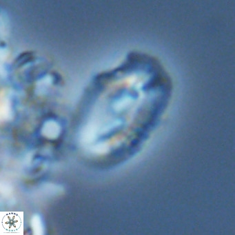 Helicosphaera consimilis VR 05888