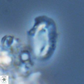 Helicosphaera consimilis VR 05889