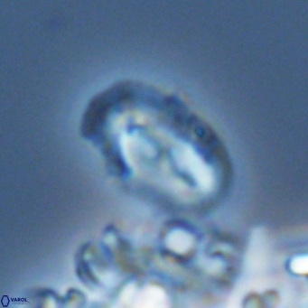 Helicosphaera consimilis VR 05890