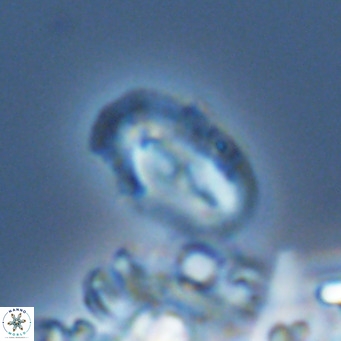 Helicosphaera consimilis VR 05890