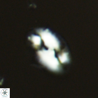 Helicosphaera consimilis VR 05378