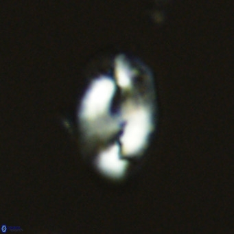 Helicosphaera consimilis VR 05379