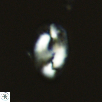 Helicosphaera consimilis VR 05379