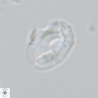 Helicosphaera consimilis VR 05383