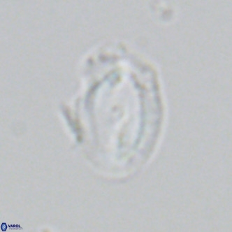 Helicosphaera consimilis VR 05385