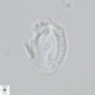 Helicosphaera consimilis VR 05385
