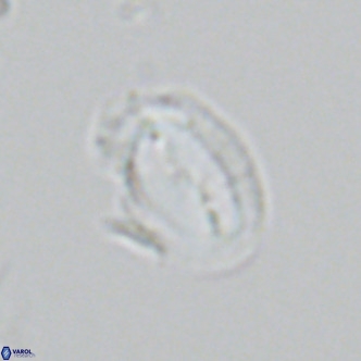 Helicosphaera consimilis VR 05386
