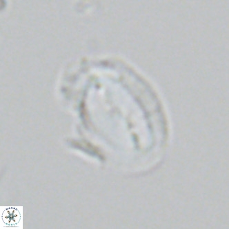 Helicosphaera consimilis VR 05386