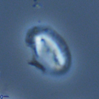 Helicosphaera consimilis VR 05387