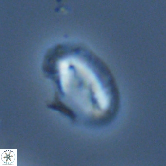 Helicosphaera consimilis VR 05387