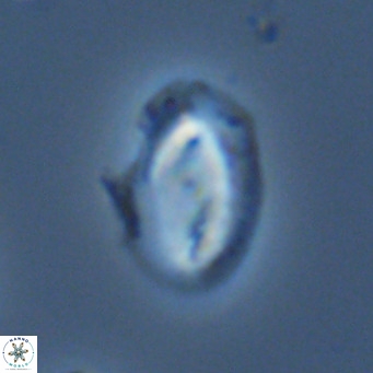 Helicosphaera consimilis VR 05389