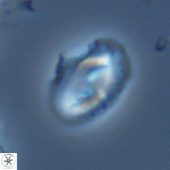 Helicosphaera consimilis VR 05390