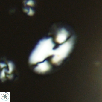 Helicosphaera consimilis VR 05391