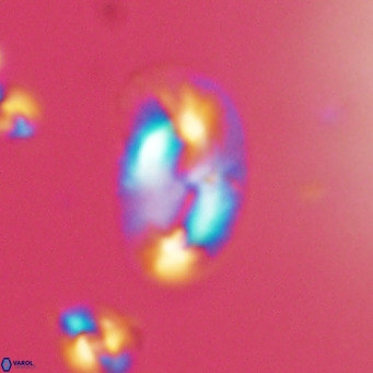 Helicosphaera consimilis VR 05393