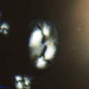 Helicosphaera consimilis VR 04539
