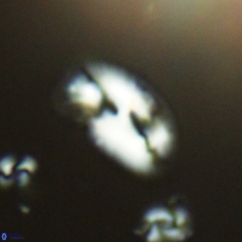 Helicosphaera consimilis VR 05395