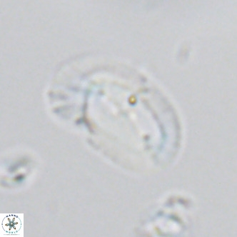 Helicosphaera consimilis VR 05398