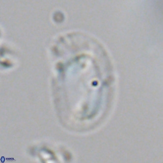 Helicosphaera consimilis VR 05399