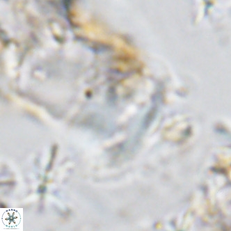 Helicosphaera consimilis VR 08316
