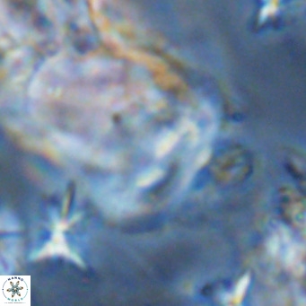 Helicosphaera consimilis VR 08317