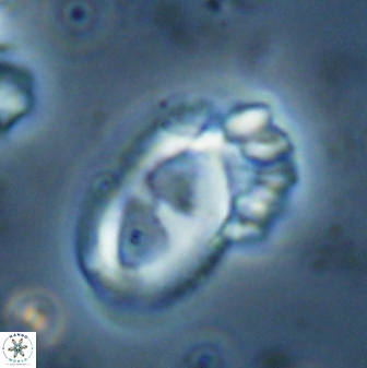 Helicosphaera crouchii 27625