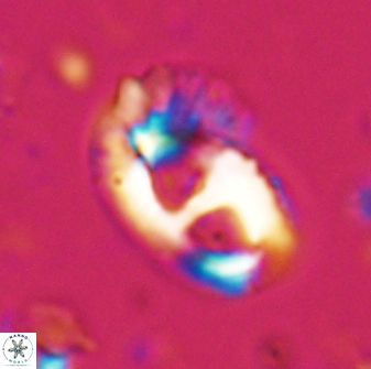 Helicosphaera crouchii 27620