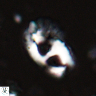 Helicosphaera crouchii 27621