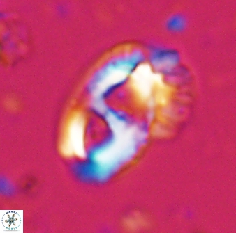 Helicosphaera crouchii 27623