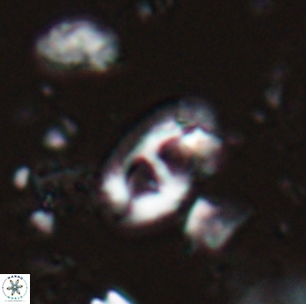 Helicosphaera crouchii 27638