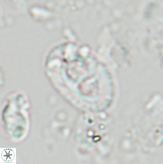 Helicosphaera crouchii 27645