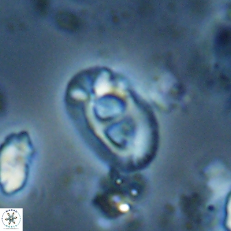 Helicosphaera crouchii 27646