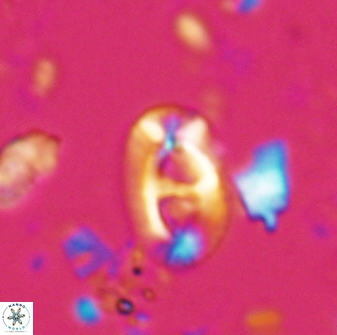 Helicosphaera crouchii 27640