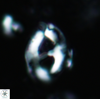 Helicosphaera crouchii 391