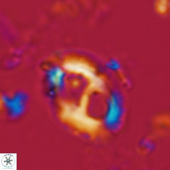 Helicosphaera crouchii 393