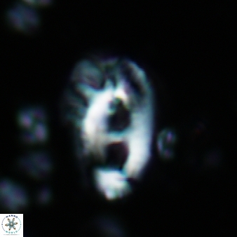 Helicosphaera crouchii 397