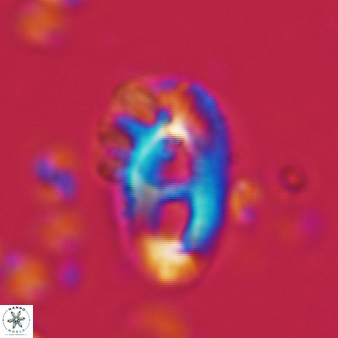 Helicosphaera crouchii 398
