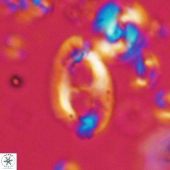 Helicosphaera crouchii 415