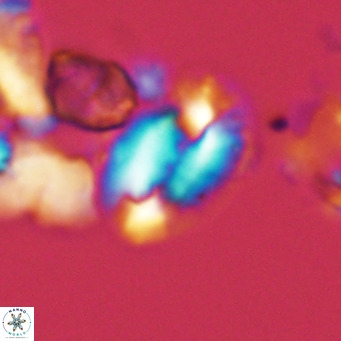 Helicosphaera dyoporous VR 05483