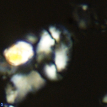 Helicosphaera dyoporous VR 05484