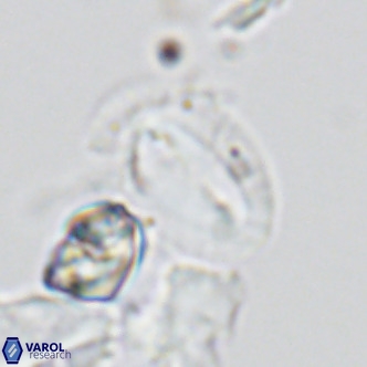 Helicosphaera dyoporous VR 05488