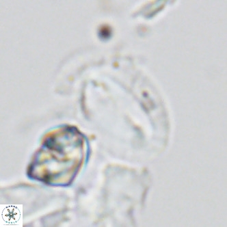 Helicosphaera dyoporous VR 05488