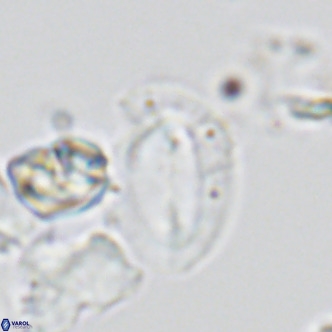 Helicosphaera dyoporous VR 05489