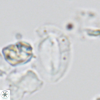 Helicosphaera dyoporous VR 05489