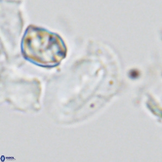 Helicosphaera dyoporous VR 05491